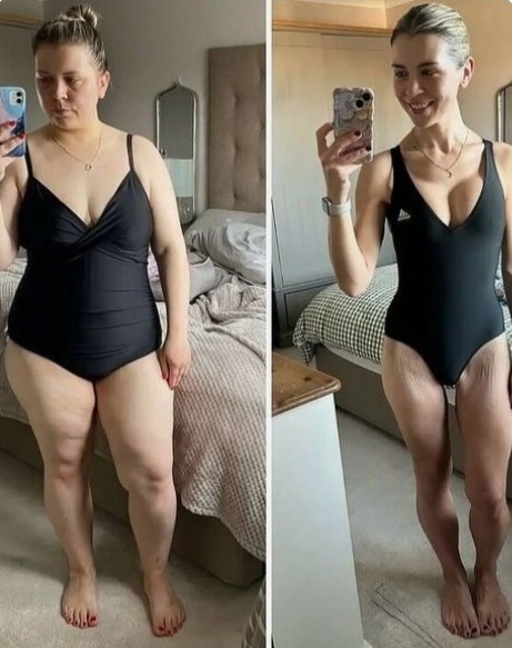 Resultado antes e depois